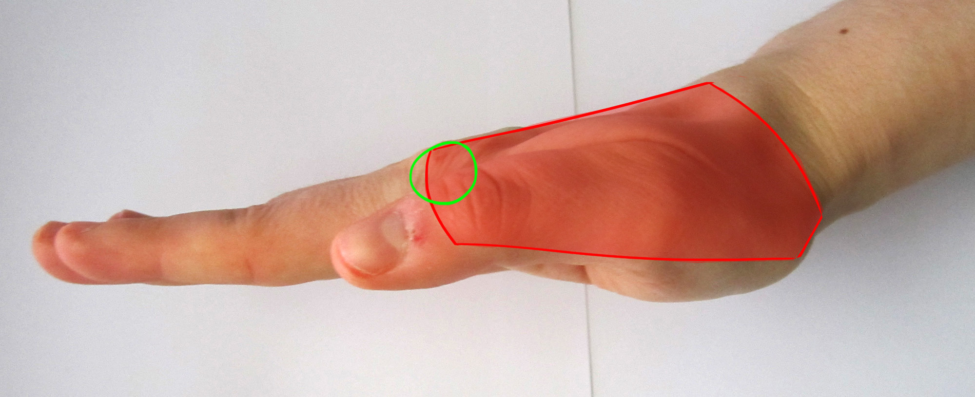Articulations de la paume de la main de profil