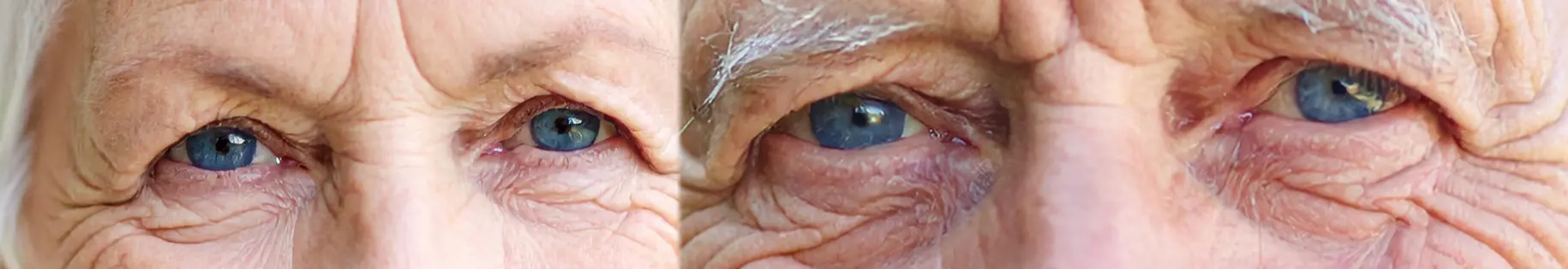 images montrant les regards de deux personnes âgées