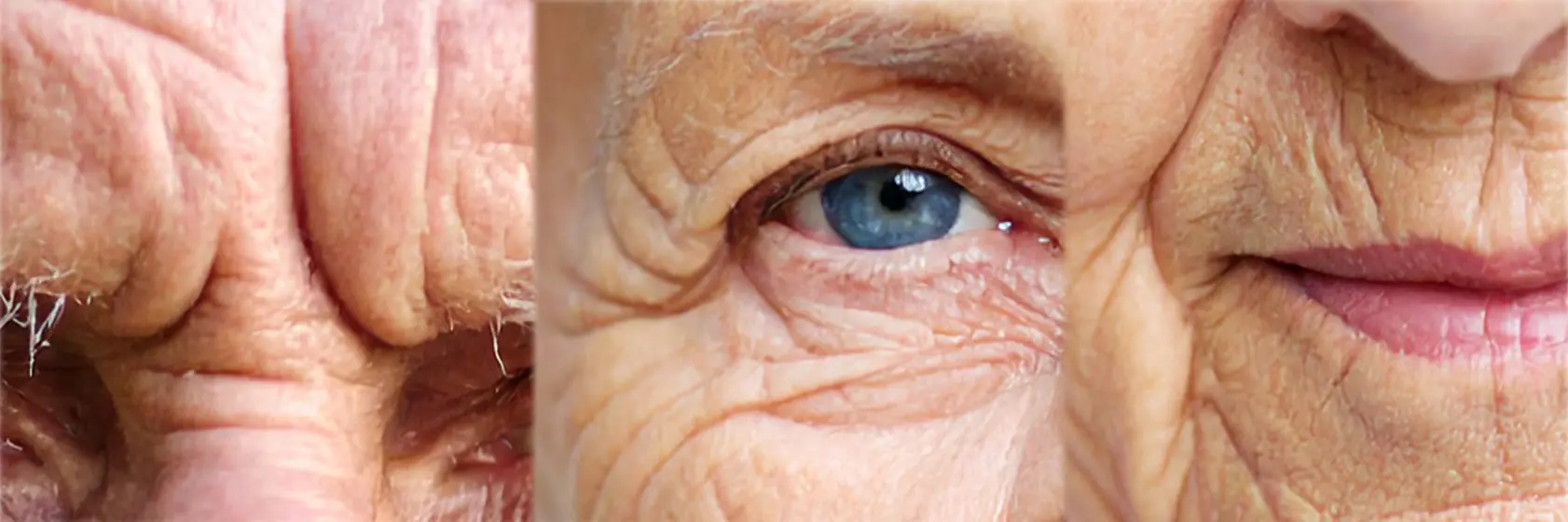 images montrant les rides chez les personnes âgées