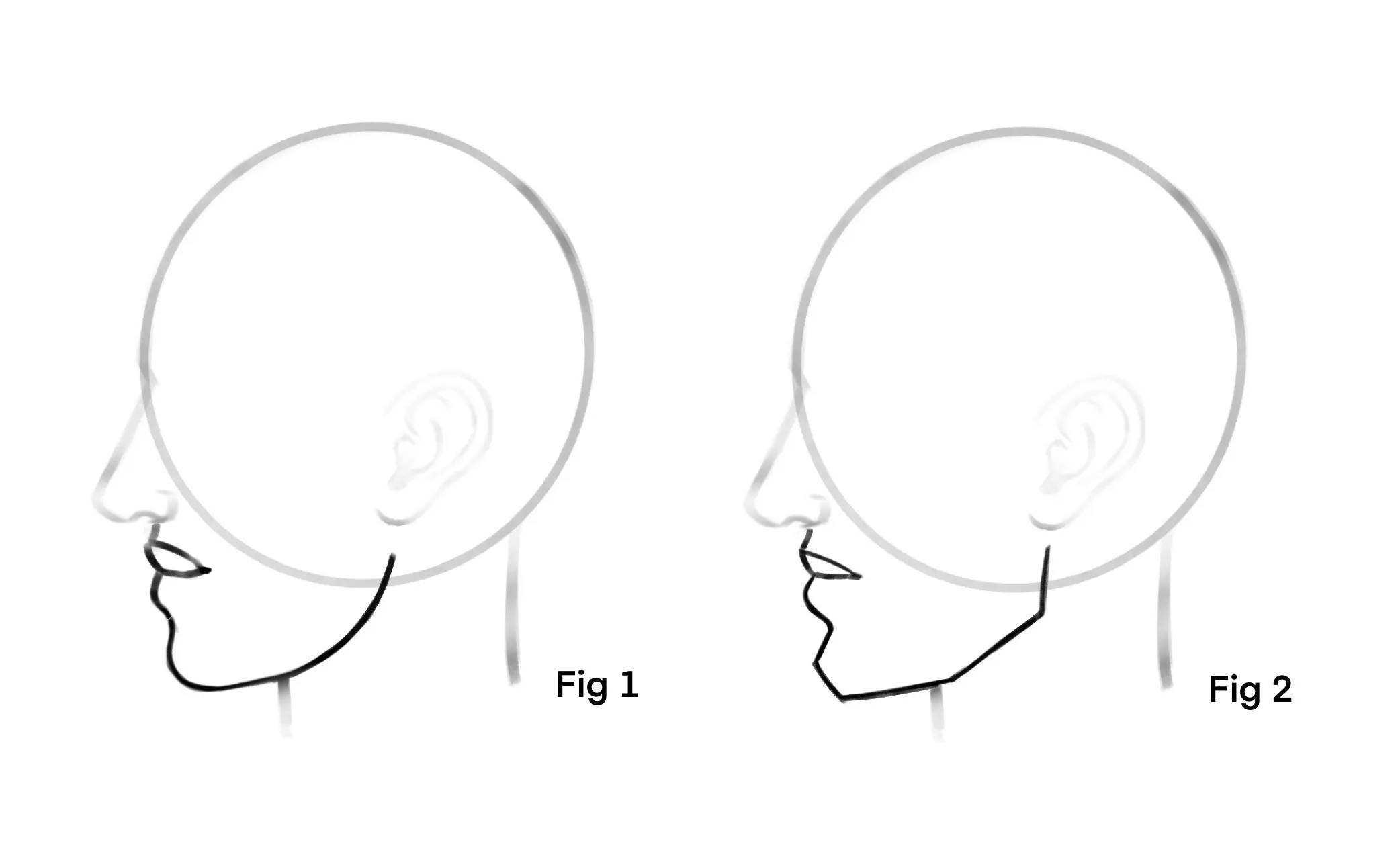 dessin du menton d’un visage de profil